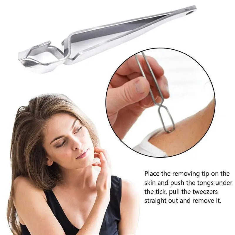Tick Remover Hook Flea Remover Tweezer Tick Pull Pet Cat Dog Ticks Removal Tools Flea Extractor Pet Supplies